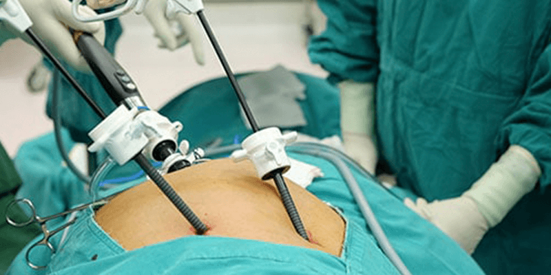 Laser Surgery in JP Nagar