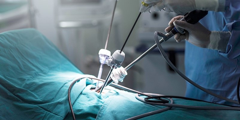 Laparoscopic surgery in Jayanagar