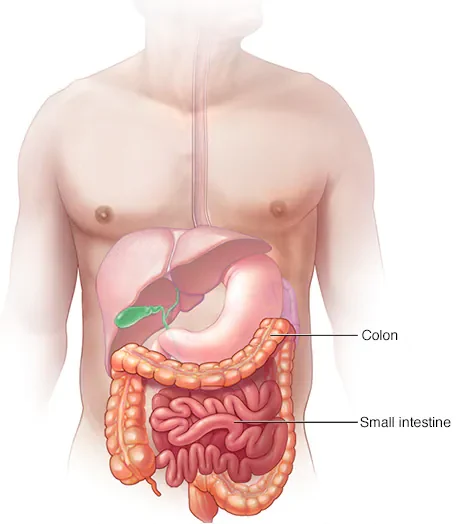 Intestinal obstruction treatment in JP Nagar